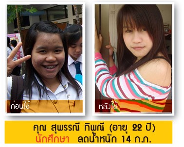 การลดความอ้วนง่ายๆ 3-50 กก. สูตรลดเอวและหน้าท้อง ลดไขมันช่วง