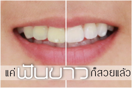?ฟันขาว? แล้ว ?หน้าเด็กลง? จริงไหม?