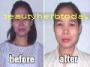 ʺ��DETOX  inoota  ��ҧ��� ��͹���� ˹���ʡ�� �ѡ����� �