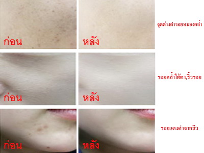 �պդ��� bb cream ���Դ��к��ا���������������͹�������դ
